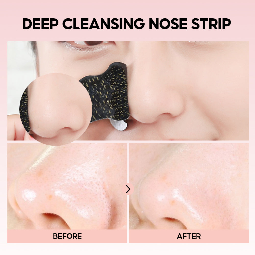 Charcoal Nose Strips