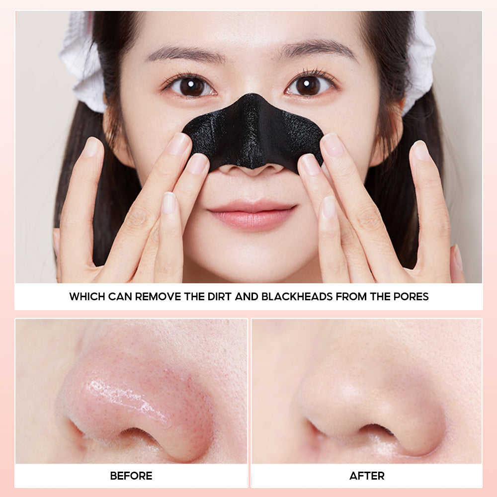 Charcoal Nose Strips